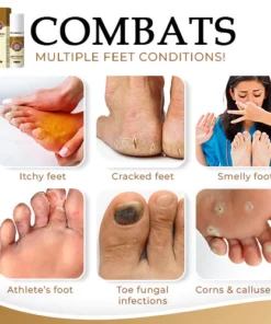 NailCure™ Anti-Fungal Foot Spray