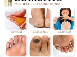 NailCure™ Anti-Fungal Foot Spray