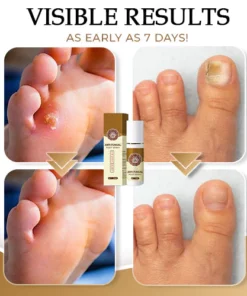NailCure™ Anti-Fungal Foot Spray
