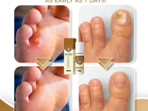 NailCure™ Anti-Fungal Foot Spray