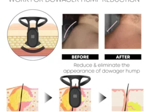 Neckology Ultrasonic LymphvitySoothing Instrument