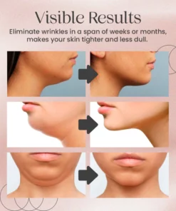 NuBeautyPlus™ EMS V-Face Device