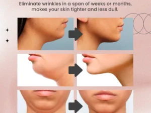 NuBeautyPlus™ EMS V-Face Device