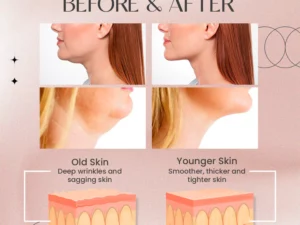 NuBeautyPlus™ EMS V-Face Device