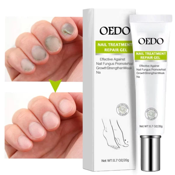 Gel de tratamiento de reparación de uñas OEDO™