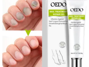 OEDO™Nail Repair Treatment Gel