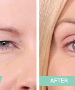One® Natural Invisible Eyelid