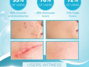 OrgPurePro™ Organic Scar Removing Gel