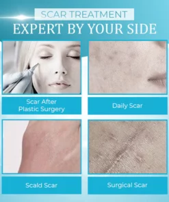 OrgPurePro™ Organic Scar Removing Gel