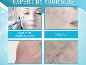 OrgPurePro™ Organic Scar Removing Gel