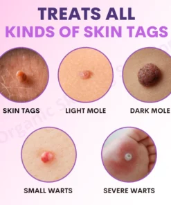 Organic SkinTag Solution
