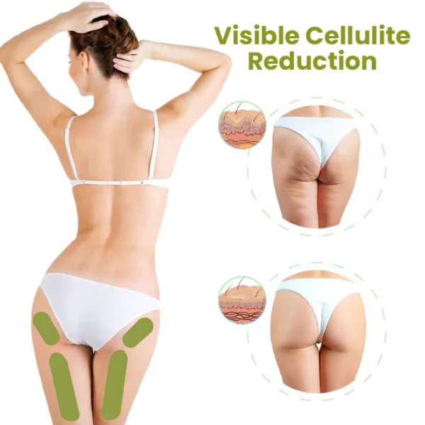 Oveallgo™ Ex HerbalFirm Cellulite Vermindering Pleisters