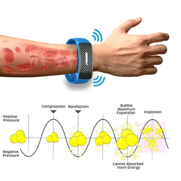 Oveallgo™ Matteo SCI ultrasone polsband in lichaamsvorm