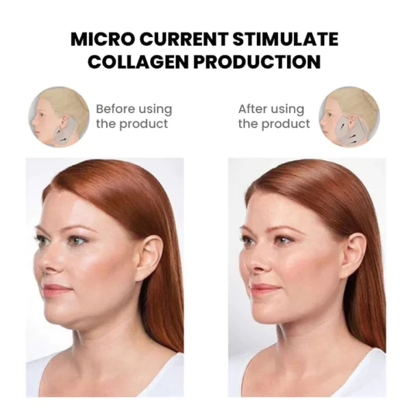 Oveallgo™ MutuTech Práctico masajeador facial en forma de V