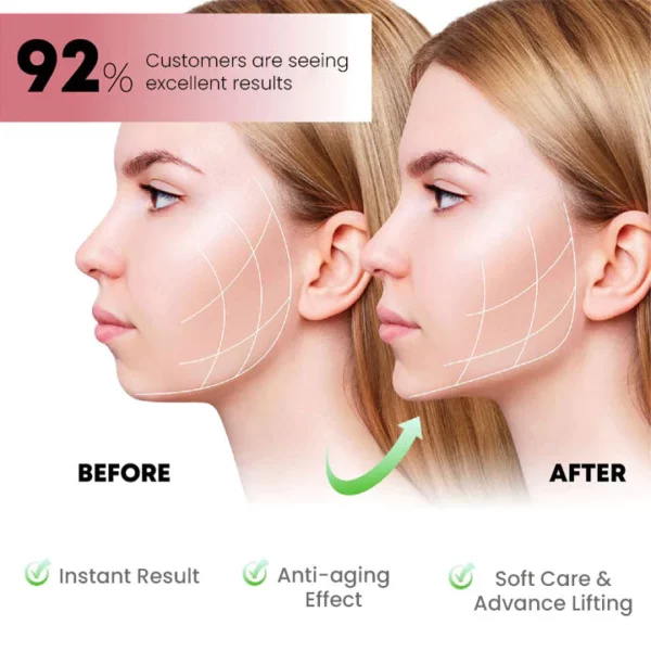 Oveallgo™ MutuTech Práctico masajeador facial en forma de V