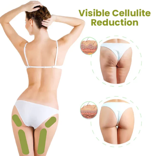 Viraka vya Oveallgo™ Pro HerbalFirm Kupunguza Cellulite