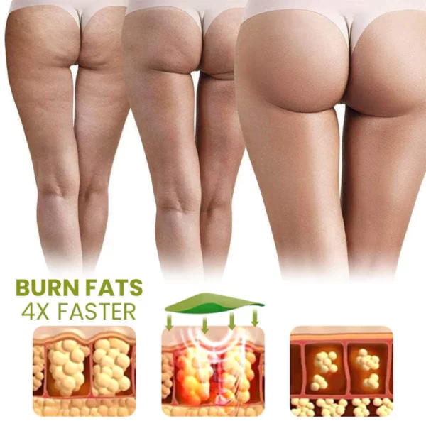 Patches Lùghdachadh Cellulite Oveallgo ™ Pro HerbalFirm