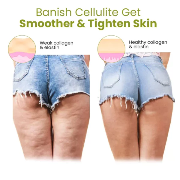 Oveallgo™ Pro HerbalFirm Patches zur Reduzierung von Cellulite