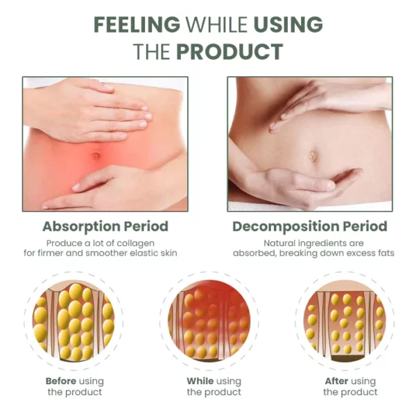 Crema para reafirmar la piel Oveallgo™ Wormwood CelluliteBeGone