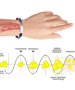 Oveallgo™ Apus Ion Therapeutic Lympunclog Titanium Wristband