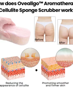 Oveallgo™ Aromatherapy Cellulite Sponge Scrubber