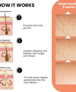 Oveallgo™ Ashwagandha 4500 Hair Growth Spray