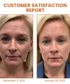 Oveallgo™ Byeol Korea Infusing Collagen Anti-aging Mask