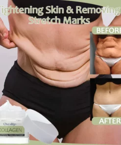 Oveallgo™ Collagen Boost Rapid Firming&Lifting Cream