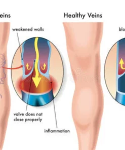 Oveallgo™ Compression Knee Brace