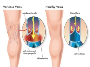Oveallgo™ Compression Knee Brace