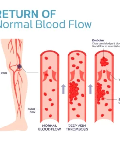 Oveallgo™ Compression Knee Brace