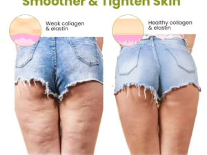 Oveallgo™ Ex HerbalFirm Cellulite Reduction Patches
