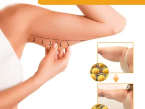 Oveallgo™ Grapefruit Cellulite-Targeting Essential Oil