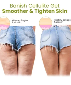 Oveallgo™ HerbalFirm Cellulite Reduction Patches