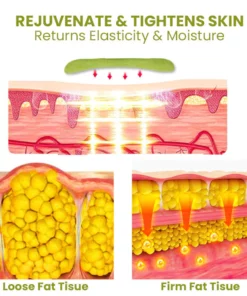 Oveallgo™ HerbalFirm Cellulite Reduction Patches