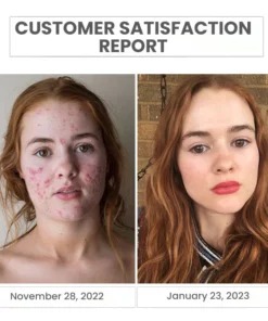 Oveallgo™ Japan Natural Amino Acid Cleansing Foam