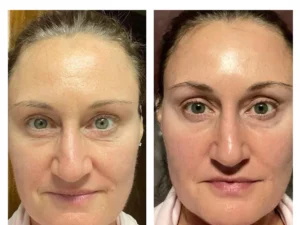 Oveallgo™ Korean Dermalayr Technology Soluble Collagen Film Pro