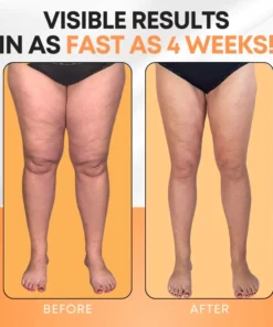 Oveallgo™ Lymphatic Drainage Health Patch