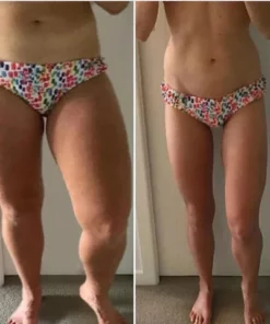 Oveallgo™ Lymphatic Drainage Health Patch