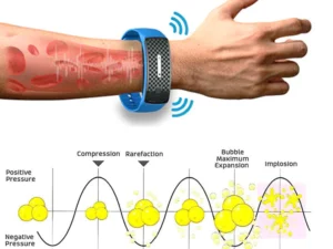 Oveallgo™ Matteo SCI Ultrasonic Body Shape Wristband