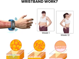 Oveallgo™ Matteo SCI Ultrasonic Body Shape Wristband