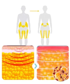 Oveallgo™ Matteo Ultrasonic Body Shape Wristband