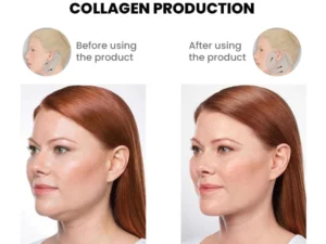 Oveallgo™ MutuTech Handy V-Shape Face Massager