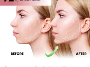 Oveallgo™ MutuTech Handy V-Shape Face Massager