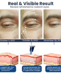 Oveallgo™ PEULINSEU NMN9900+ Awaken Peptide Depuffing Eye Gel