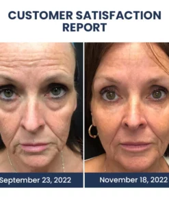 Oveallgo™ PEULINSEU NMN9900+ Awaken Peptide Depuffing Eye Gel