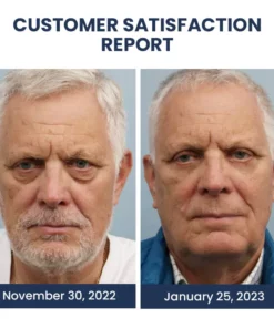 Oveallgo™ PEULINSEU NMN9900+ Awaken Peptide Depuffing Eye Gel