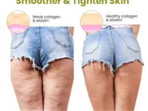 Oveallgo™ Pro HerbalFirm Cellulite Reduction Patches