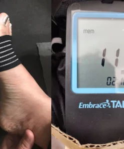 Oveallgo™ Sugar Down Foot Acupressure-Pads