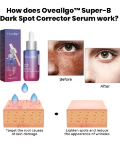 Oveallgo™ Super-B Dark Spot Corrector Serum